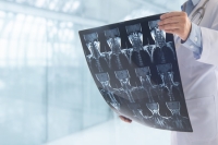 Preparing for Surgery with a Pre-Op Evaluation